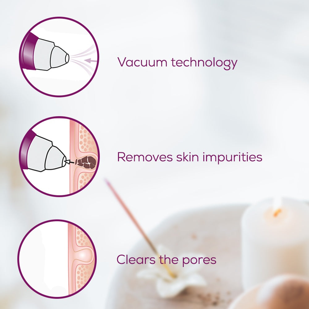 Beurer FC 41 Pore Cleanser: Power Deep Vacuum Cleanser Rechargeable via USB