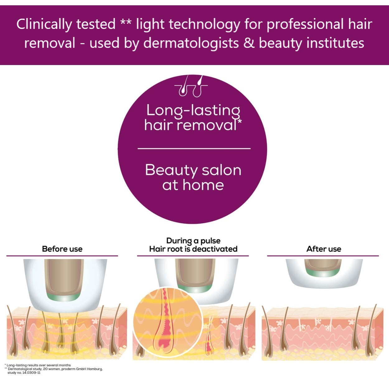 Beurer IPL Precision Face & Bikini Attachment for use with Beurer IPL 9000 + & IPL 10000 + Salon Pro IPL Devices